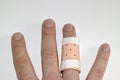 Right hand with a splint on the ring finger Royalty Free Stock Photo