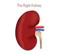 Right kidney transplant.