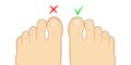 Right to cut toenails