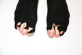 Ripped socks on man`s feet. Shabby clothes. Poor person