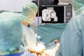 Team of doctor perform total hip arthroplasty replacement surgery in osteoarthritis patient inside the operating room. mako robot-