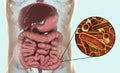 Rod-shaped bacteria Shigella which cause food-borne infection shigellosis or dysentery