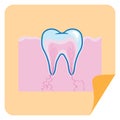 root canal in a tooth. Vector illustration decorative design Royalty Free Stock Photo