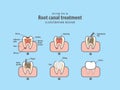 Root canal treatment illustration vector on blue background.