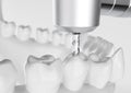 Root treatment with a drill closeup - 3D Rendering Royalty Free Stock Photo
