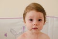 Roseola infantum Royalty Free Stock Photo