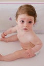 Roseola infantum Royalty Free Stock Photo