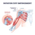 Rotator cuff impingement and anatomical shoulder muscle outline diagram Royalty Free Stock Photo