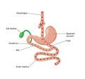 Roux-en-Y gastric bypass operation Royalty Free Stock Photo