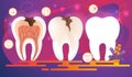 Row of Teeth with Dental Problems. Cross Section