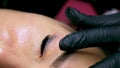 rubbing the tattoo removal compound over the surface of the traumatized eyelid. removing old permanent eyelid makeup