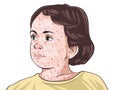 Rubella, is an infection caused by the rubella virus