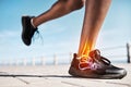 Running shoes, legs or skeleton bone glow in workout, training or exercise with anatomy pain, body stress or joint Royalty Free Stock Photo