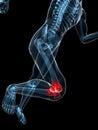 Running skeleton - painful knee Royalty Free Stock Photo