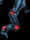 Running skeleton - painful knee and hip Royalty Free Stock Photo