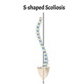 S-shaped scoliosis. Dextroscoliosis. Levoscoliosis. Spinal curvature, kyphosis, lordosis, scoliosis, arthrosis