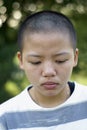 Sad bald asian teen girl Royalty Free Stock Photo