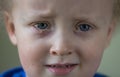 Sad and crying child with purulent conjunctivitis, contagious eye infection. Symptoms and treatment concept. Close up Royalty Free Stock Photo