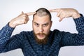 Sad guy with alopecia on head, touching hair and looks in the mirror. Spot Baldness, Hair fall problem Royalty Free Stock Photo
