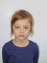 Sad little girl ill with varicella virus or chickenpox bubble rash on her face