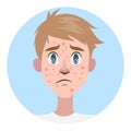 Sad man with acne on the face Royalty Free Stock Photo