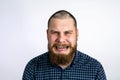 Sad Man with alopecia on head, cry. Spot Baldness, Hair fall problem Royalty Free Stock Photo