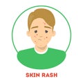 Sad man with a skin rash, dermatology disease. Person