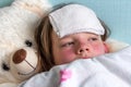 Sad sick girl with towel on forehead lays in bed. Cold compress for headache and high fever in case of flu or infection Royalty Free Stock Photo