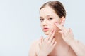 Teenage girl having acne on cheek isolated on grey Royalty Free Stock Photo
