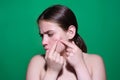 Sad Woman squeeze out pimples on cheek. Acne and pimple on skin. Dermatology, puberty woman. Pimples problem skin. Girl