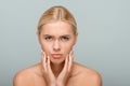 Sad young woman touching face with acne Royalty Free Stock Photo