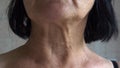 saggy chin of an elderly woman