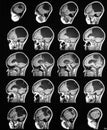 Sagittal brain mri Royalty Free Stock Photo