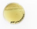 Salmonella growing on bismuth sulphite agar