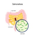 Salmonellosis. human intestines and bacterium that cause this disease