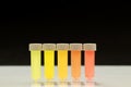 Sample tubes with orange and yellow chemicals.