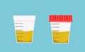 Sample of urine test vector illustration. Containers for analysis Royalty Free Stock Photo