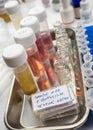 Samples contaminated by Clostridium botulinum toxin that causes botulism in humans, laboratory research Royalty Free Stock Photo