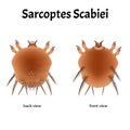 Sarcoptes scabiei. scabies. Sexually transmitted disease. Infographics. illustration on isolated background.