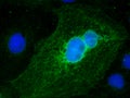 Sars-Cov-2 coronavirus infected Vero E6 cells reacting to antibody raised against nsp and structural proteins