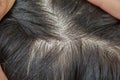 Scalp and dandruff Skin problems and itching