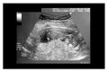 Scan for pregnancy Royalty Free Stock Photo