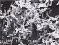 Scanning electron microscope photo of vibrio bacteria x5000
