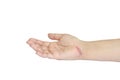 scar on hand isolated on white background, clipping path include