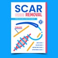 Scar Removal Creative Advertising Banner Vector