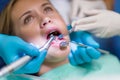 Scared patient at dentist office closeup mouth Royalty Free Stock Photo