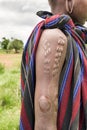 Scarification typical for the Mursi tribe in Ethiopia Royalty Free Stock Photo