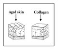 Schema of the skin under the influence of collagen.