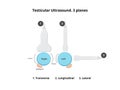 Schematic illustration of the testicular ultrasound scan