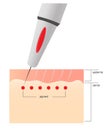 The scheme of the procedure of permanent makeup. Royalty Free Stock Photo
